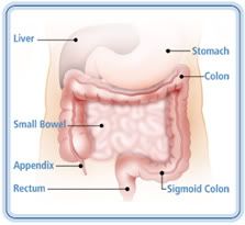 A Homeopathic Approach to Inflammatory Bowel Disease – Crohn’s and Colitis 11